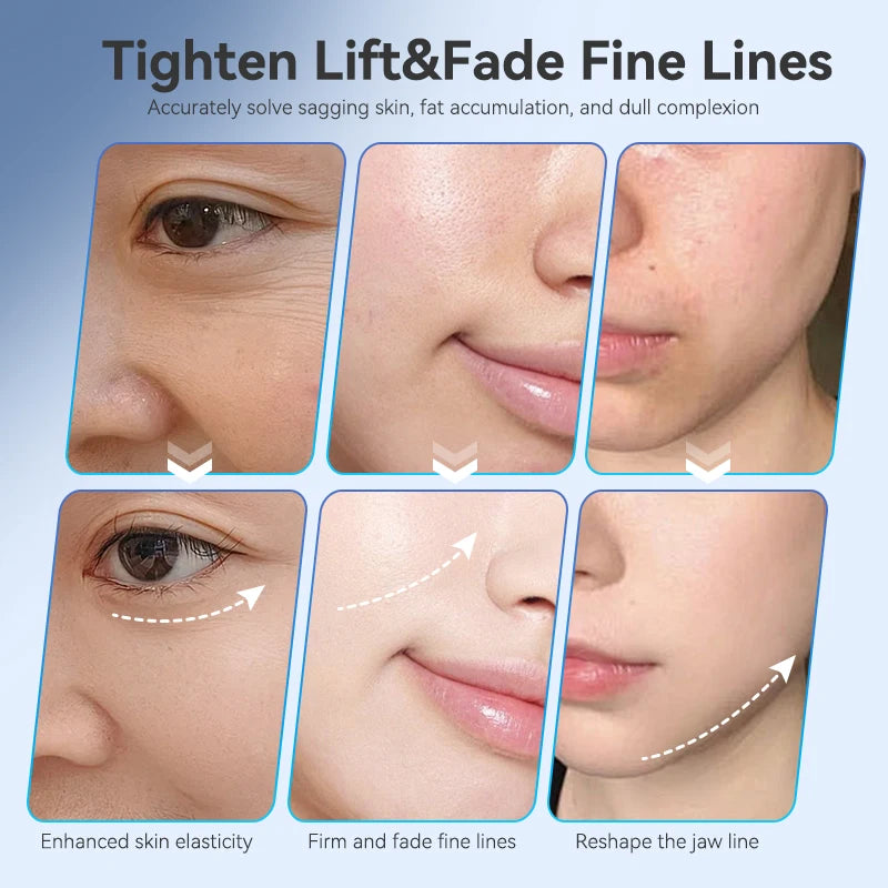 Suction Facial Lifting Massager