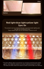 LED Red Light Therapy Face Mask